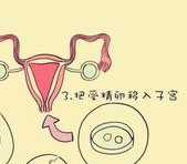 2026年温州医科附属第二医院三代试管婴儿基本费用明细速览