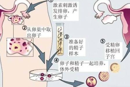 德州禹城市试管婴儿哪家好，德州禹城市试管婴儿哪家好一点